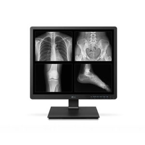 Màn hình đánh giá lâm sàng 19 inch LG 19HK312C – Màn Hình Y tế